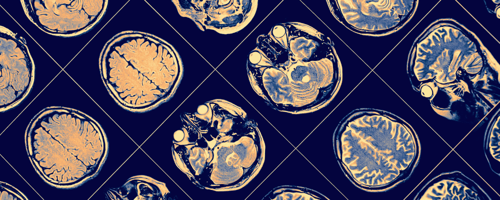 Brain scans from multiple angles.